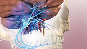 Trigeminal Neuralgia